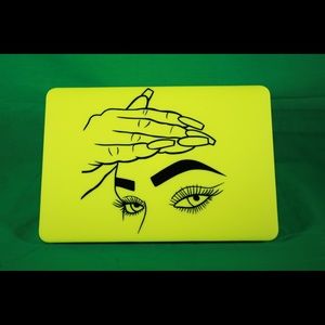 Neon Yellow MacBook Case with vinyl artwork